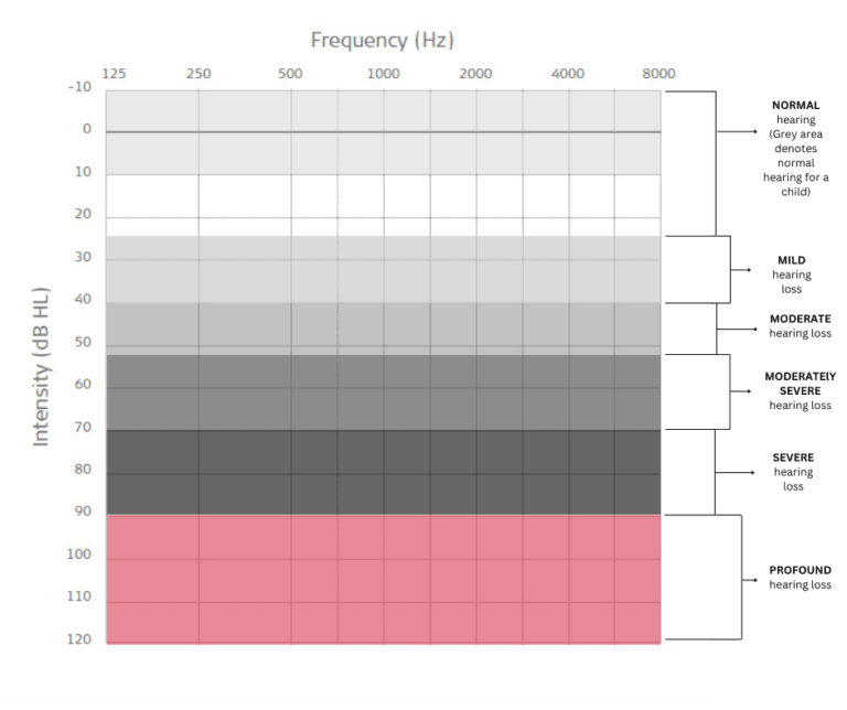 Audiogram Advanced Hearing WA